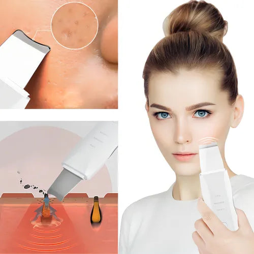 Espatula facial Ultrasonido 3 en 1